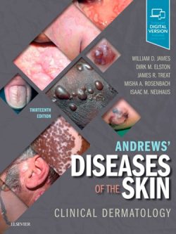 Andrews’ Diseases of the Skin: Clinical Dermatology (13th Edition) – eBook