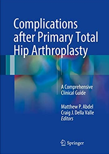 Complications after Primary Total Hip Arthroplasty: A Comprehensive Clinical Guide, ISBN-13: 978-3319549118