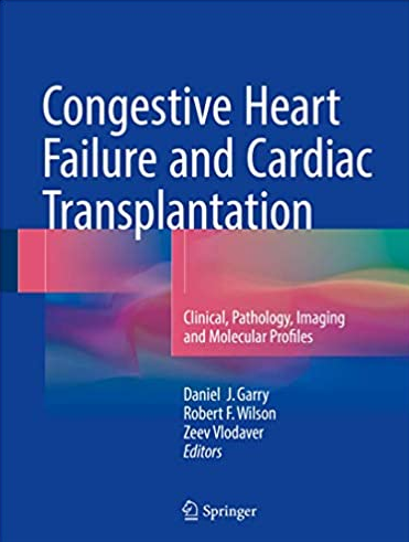 Congestive Heart Failure and Cardiac Transplantation, ISBN-13: 978-3319445755