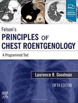 Felson’s Principles of Chest Roentgenology (5th Edition) – eBook