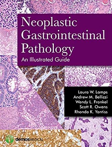 Neoplastic Gastrointestinal Pathology: An Illustrated Guide, ISBN-13: 978-1936287727