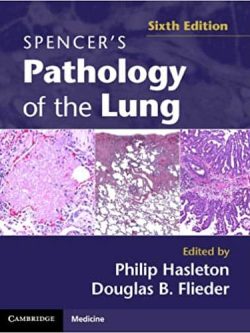 Spencer’s Pathology of the Lung (6th Edition) – eBook PDF